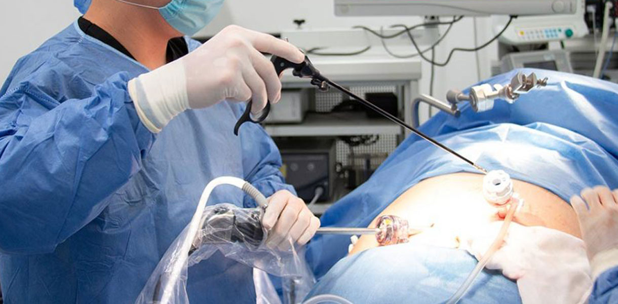 Mini Gastrik Bypass - Doç Dr Çağhan Pekşen Obezite Cerrahisi Obezite Ameliyatı