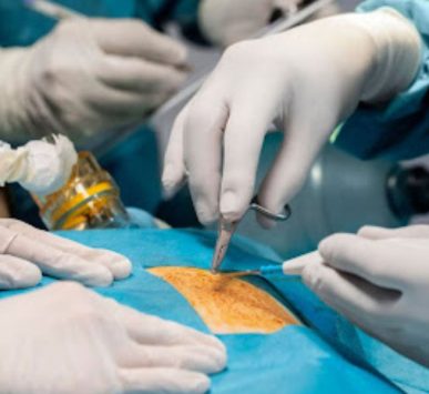 Fıtık Ameliyatı Doç.Dr Çağhan Pekşen Genel Cerrahi Uzmanı