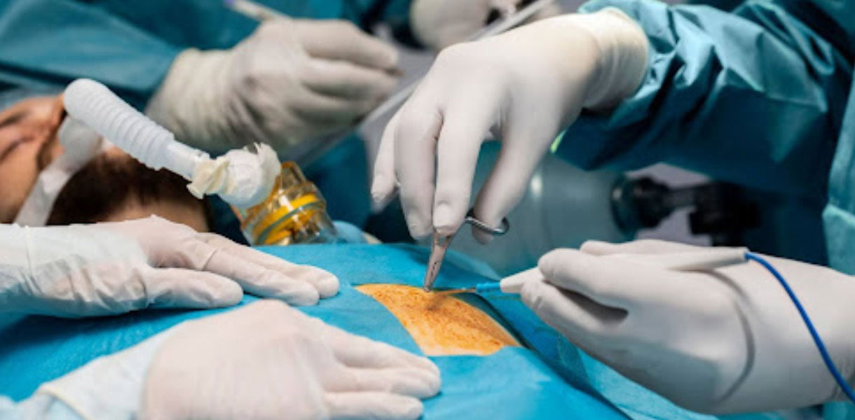 Fıtık Ameliyatı Doç.Dr Çağhan Pekşen Genel Cerrahi Uzmanı