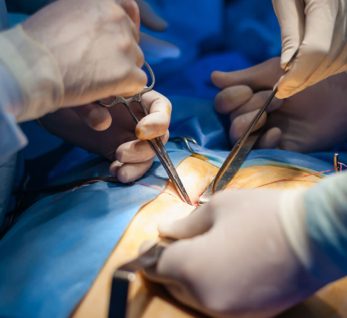 Safra Kesesi İltihabı Tedavisi - Akut Kolesistit İltihaplı Safra Kesesi Tedavisi Ameliyatı En İyi doktor Genel Cerrahi Uzmanı doktoru istanbul uzmanı doktorları Doç.Dr Çağhan Pekşen Genel Cerrahi Uzmanı Safra Kesesi İltihaplanması Safra Kesesi İltihabı Tedavisi Ameliyatı Kapalı Safra Kesesi Ameliyatı Yorumları Akut Kolesistit Ameliyatı