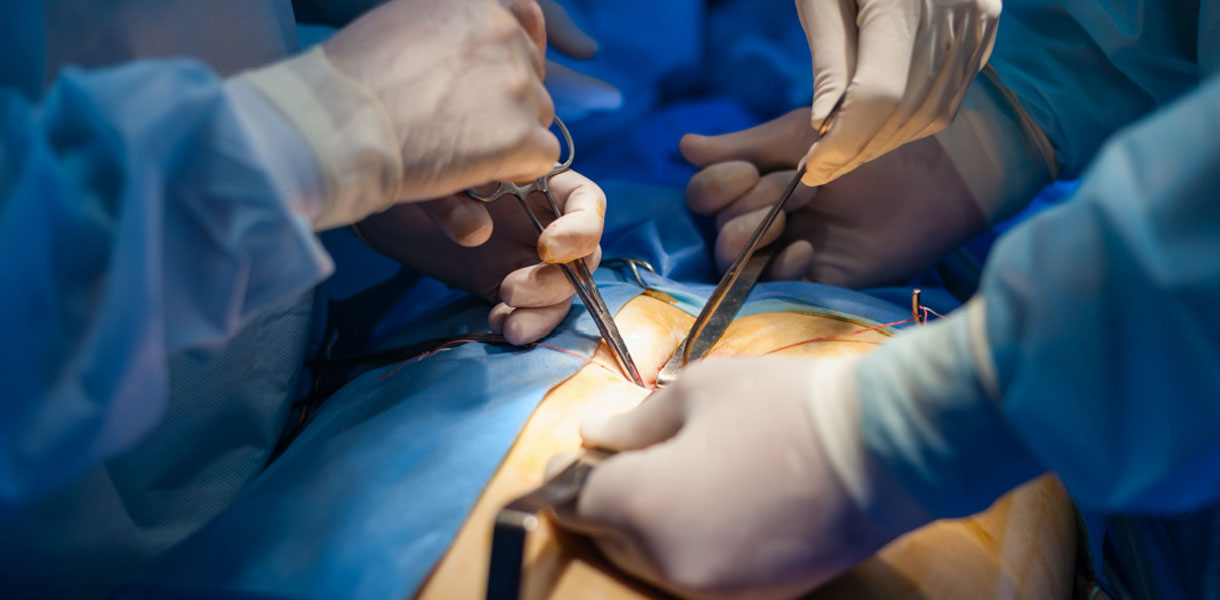 Safra Kesesi İltihabı Tedavisi - Akut Kolesistit  İltihaplı Safra Kesesi Tedavisi Ameliyatı En İyi doktor Genel Cerrahi Uzmanı doktoru istanbul uzmanı doktorları Doç.Dr Çağhan Pekşen Genel Cerrahi Uzmanı Safra Kesesi İltihaplanması Safra Kesesi İltihabı Tedavisi Ameliyatı Kapalı Safra Kesesi Ameliyatı Yorumları Akut Kolesistit Ameliyatı